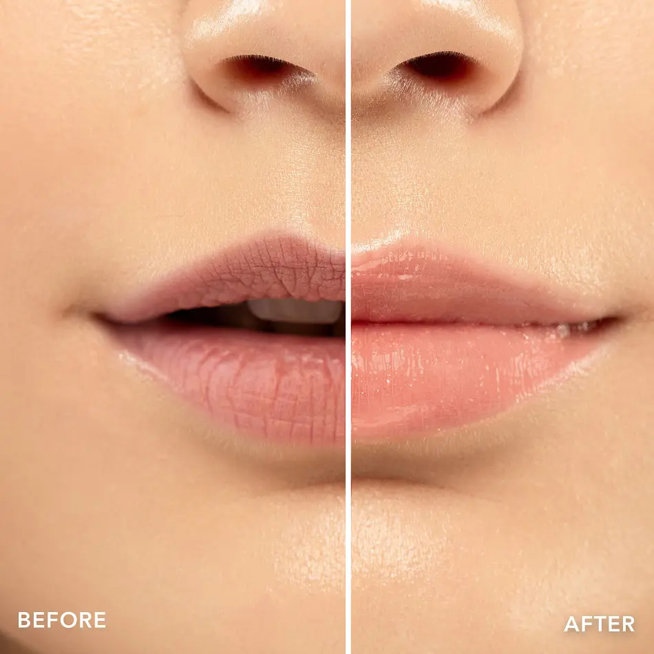 20 Ways To Get Rid of Dry, Chapped Lips