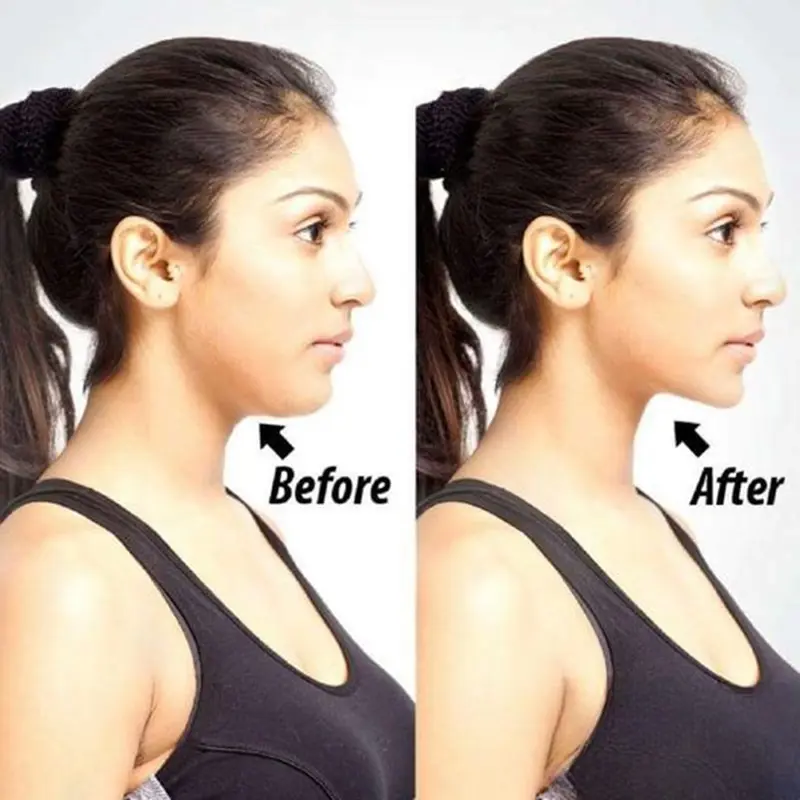 14 Ways To Get Rid of A Double Chin Without Surgery